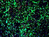 Neural stem cells, fluorescence light micrograph