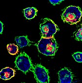 RNA nanotechnology cancer treatment