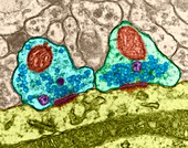 Excitatory synapses on a dendrite, TEM