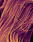 Heart muscle collagen fibres, SEM