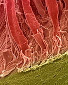 Tendons attached to bone surface, SEM