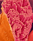 Skeletal muscle actin myosin filaments, SEM