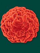 Muscle myoblast sphere, SEM