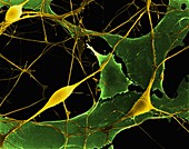 Pyramidal neurons from CNS, SEM