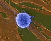 T lymphocyte attacking tumour cells, SEM