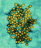 Yellow Fever Virus, TEM