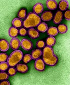 Human Swine Flu Virus H1N1, TEM