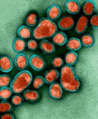 Human Swine Flu Virus H1N1, TEM