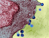 HIV infection in lymph tissue, TEM
