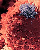 T lymphocyte with HTLV-1 infection, SEM