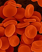 Red blood cells in isotonic solution, SEM