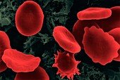 Red blood cells in hypertonic solution, SEM