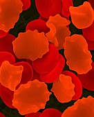 Red blood cells in hypertonic solution, SEM