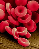 Red blood cells on a blood vessel, SEM