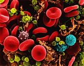 Red blood cells, T lymphocytes, platelets and fibrin, SEM