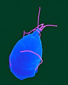 Giardia lamblia, parasitic protozoan, SEM