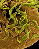 Trypanosome trypomastigote protozoan, SEM