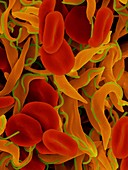 Trypanosome trypomastigote and red blood cells, SEM