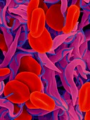 Trypanosome trypomastigote and red blood cells, SEM