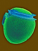Phalacroma rotundatum, SEM