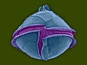 Heterotrophic dinoflagellate (Oblea sp.), SEM