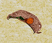 Protozoan (Giardia sp.), TEM
