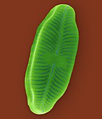 Moist soil pennate diatom (Navicula sp.), SEM