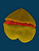 Toxic marine dinoflagellate (Karenia brevis) , SEM
