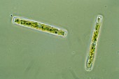 Fresh water pennate diatom (Hantzschia sp.), LM