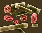 Diatom frustules (centric), SEM