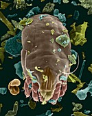 Dust mite, SEM