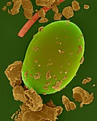 Dust mite egg (Dermatophagoides sp.), SEM