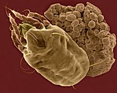 Dust mite and faecal pellet, SEM