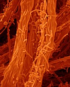 Filamentous iron oxidizing bacterium, SEM