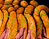 E. coli on small intestine surface, SEM