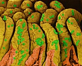 Enterococcus faecium on the small intestine, SEM