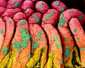 Staphylococcus aureus on the small intestine, SEM