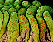 Staphylococcus aureus on the small intestine, SEM