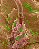 Staphylococcus aureus on human skin, SEM