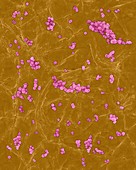 Staphylococcus aureus on human skin, SEM