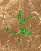 Bacillus anthracis, vegetative stage, SEM