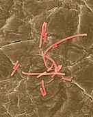 Bacillus anthracis, vegetative stage, SEM