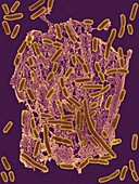 E. coli (0157:H7), rod, haemorrhagic bacterium, SEM