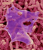 Streptomyces hygroscopicus, SEM