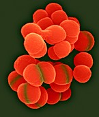 Deinococcus radiophilus, coccoid prokaryote, SEM