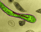 Aquaspirillum magnetotacticum, TEM