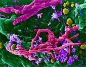 Kitchen sponge with bacteria and fungus, SEM