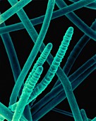 Cyanobacterium (Scytonema sp.), SEM
