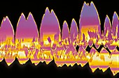 Testosterone crystals, LM