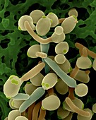Candida albicans, yeast and new hyphae stages, SEM